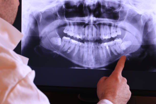 Best Pediatric Emergency Dentist in Big Stone Gap, VA